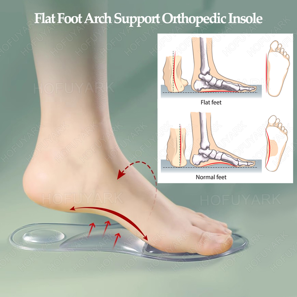 Silicone Gel Insoles Orthopedi - Women'S Shoes With Plantar Fasciitis review and price